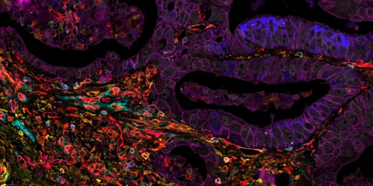 Now Boost Your Cancer Imaging Know-how